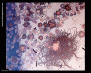 bacterial colonies